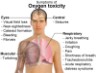 oxygen toxicity